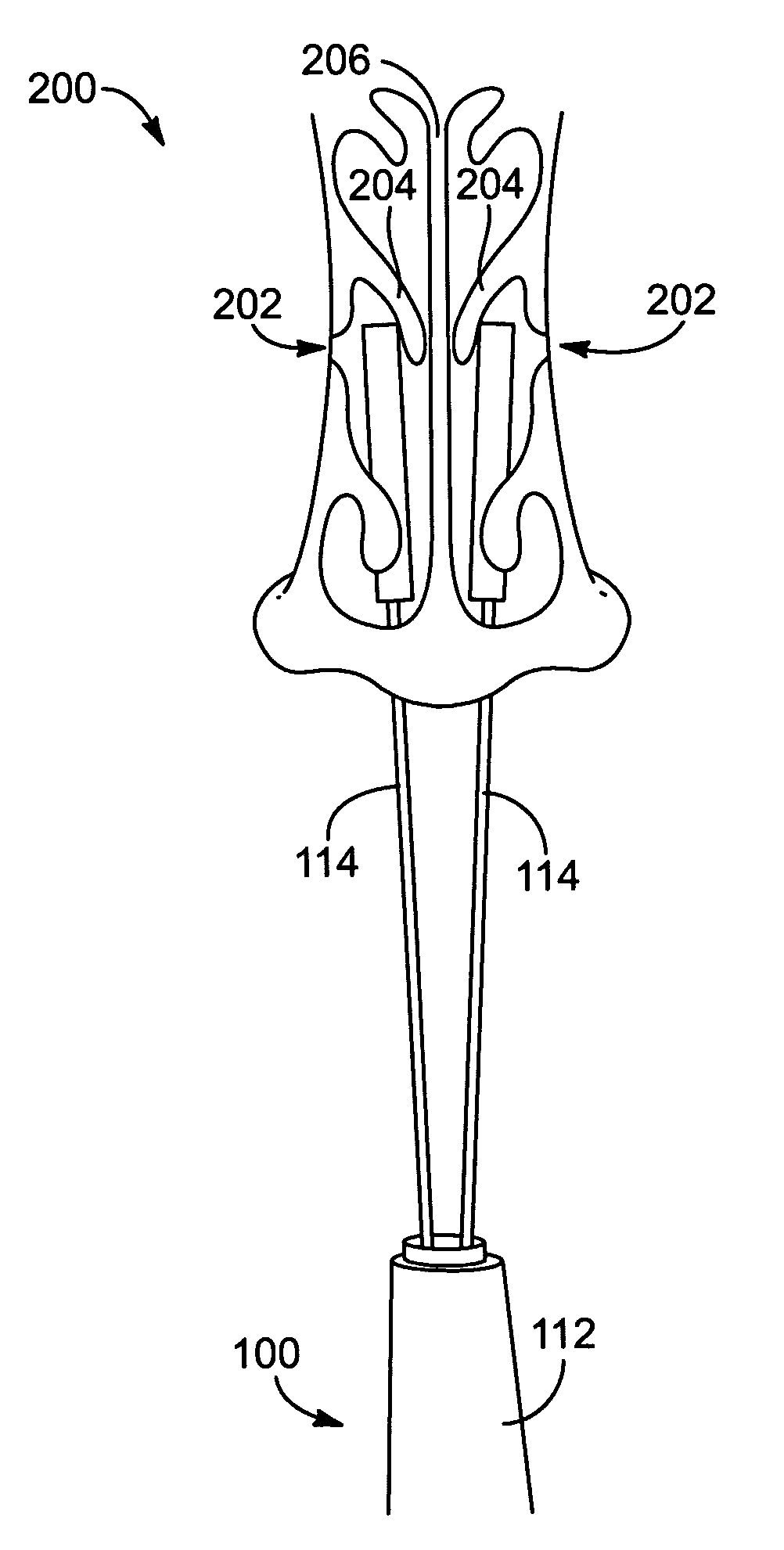 Apparatus, system, and method for middle turbinate medializer