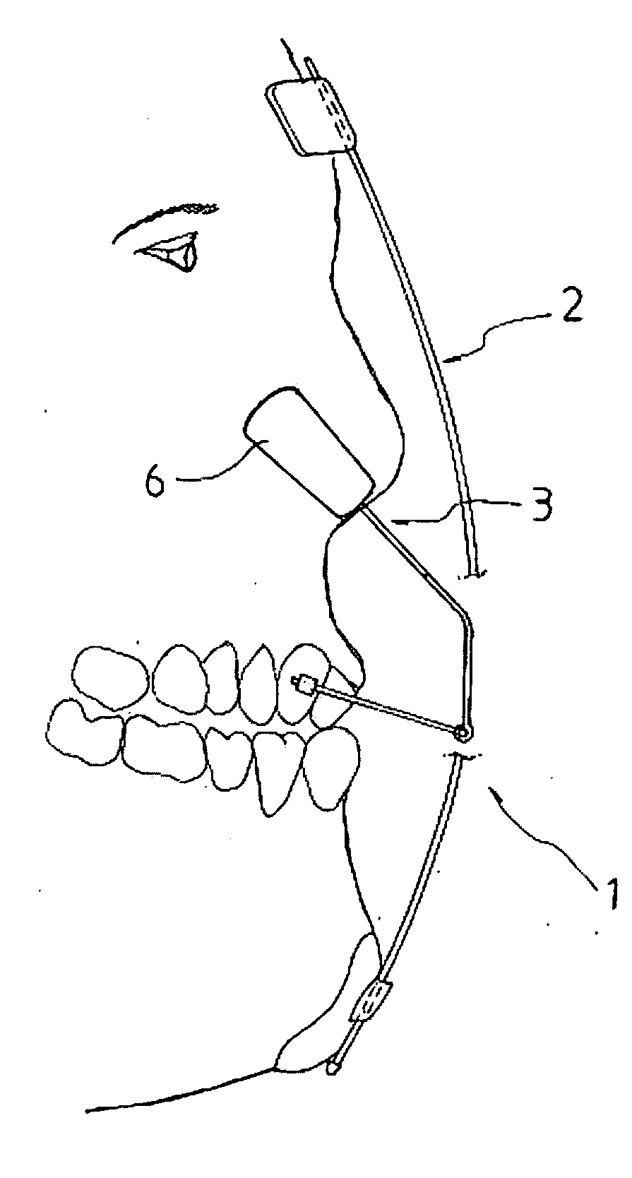 Nasal and maxillary growth enhancer