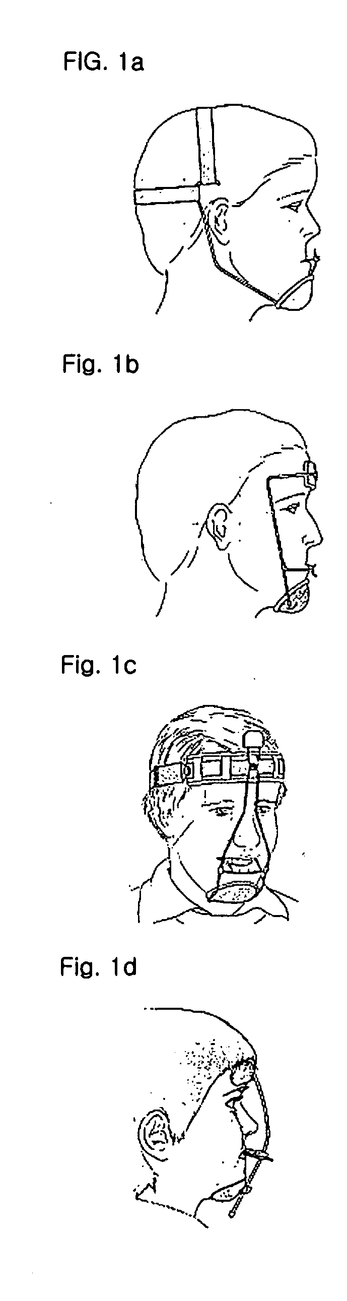 Nasal and maxillary growth enhancer