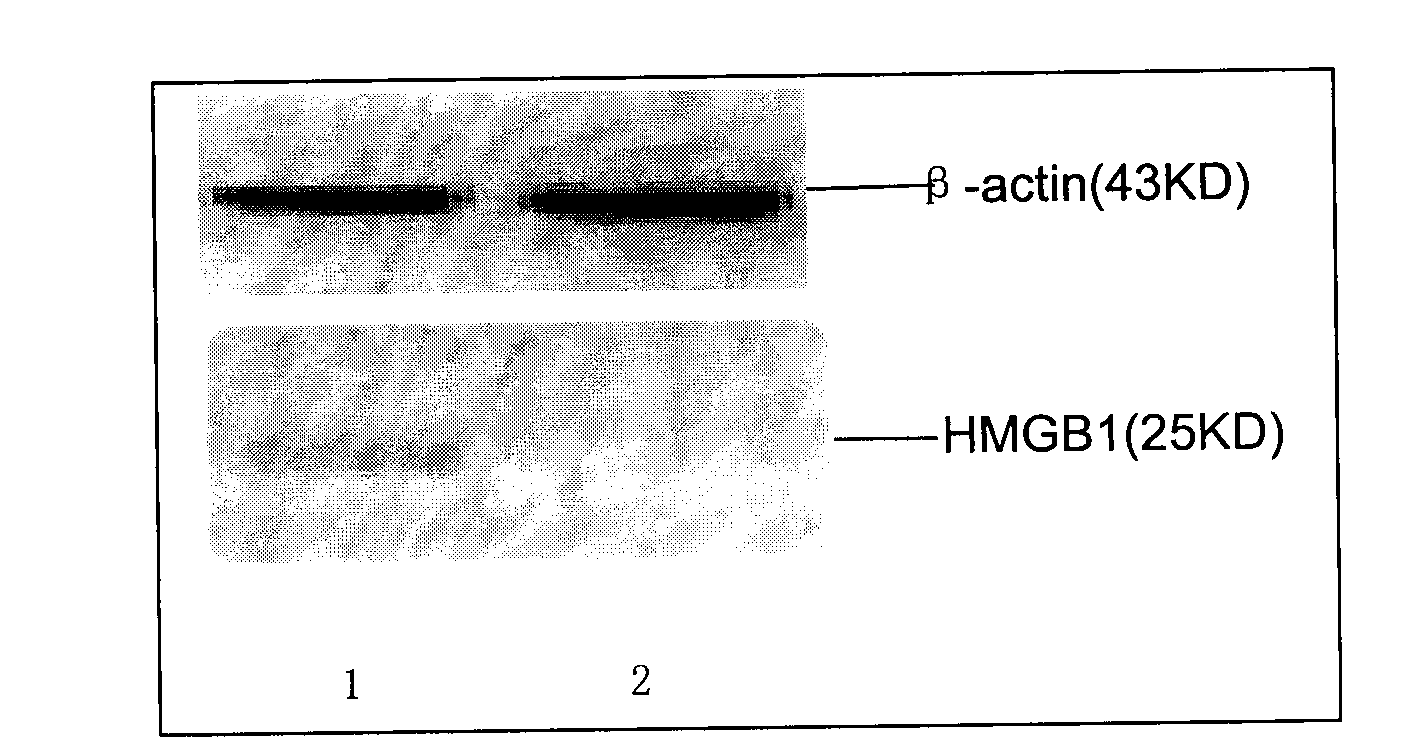 Plasmid for silencing cytokine signal inhibitory factor 1 and expressing high mobility group B1 protein and tumor associated antigen and preparation method thereof