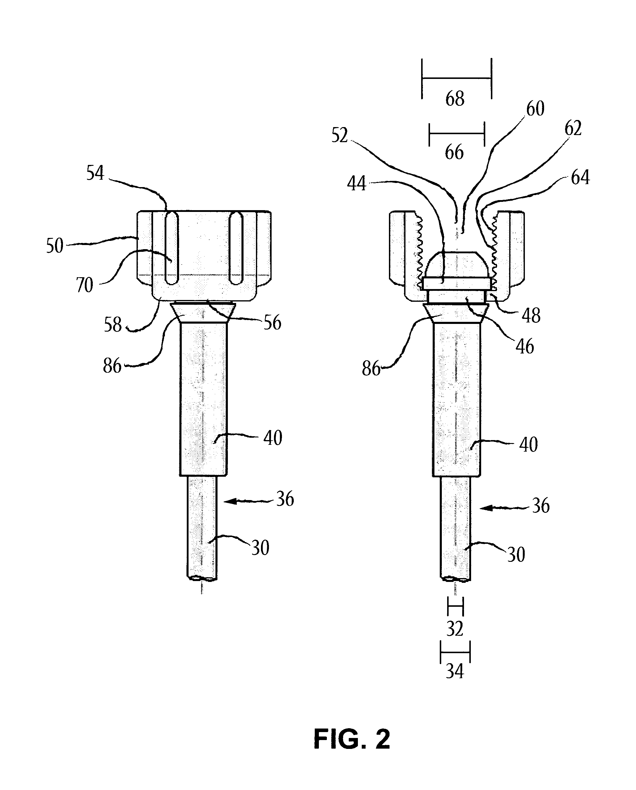 Universal medical gas delivery system