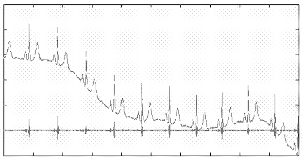 Electrocardiosignal baseline leveling method based on wavelet decomposition and spline interpolation