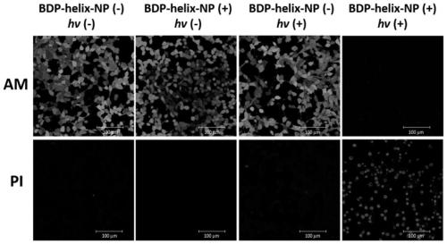 Application of near-infrared weightless atom Bodipy to photodynamic therapy of metastatic tumor and upconversion