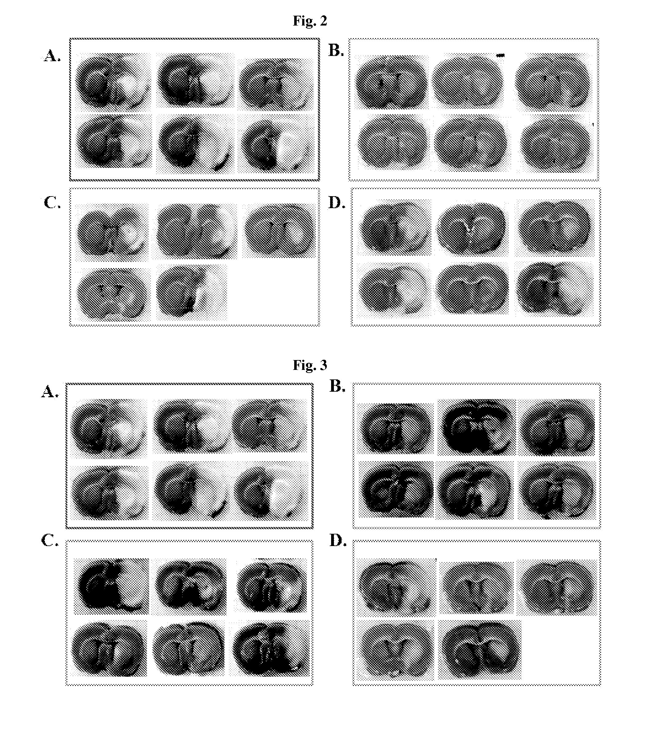 Phenyl carbamate compounds for use in preventing or treating stroke