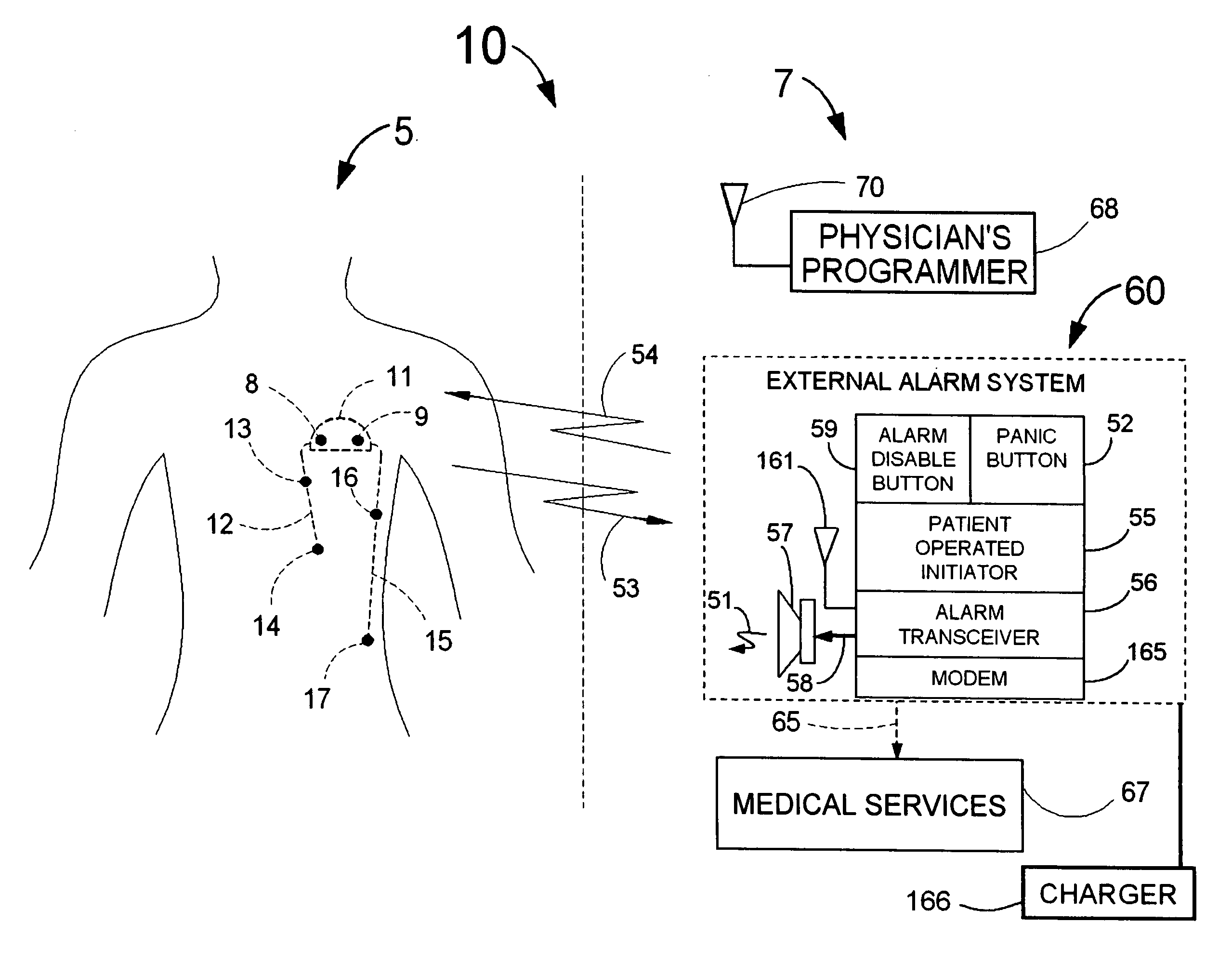 Cardiac event detection over varying time scale