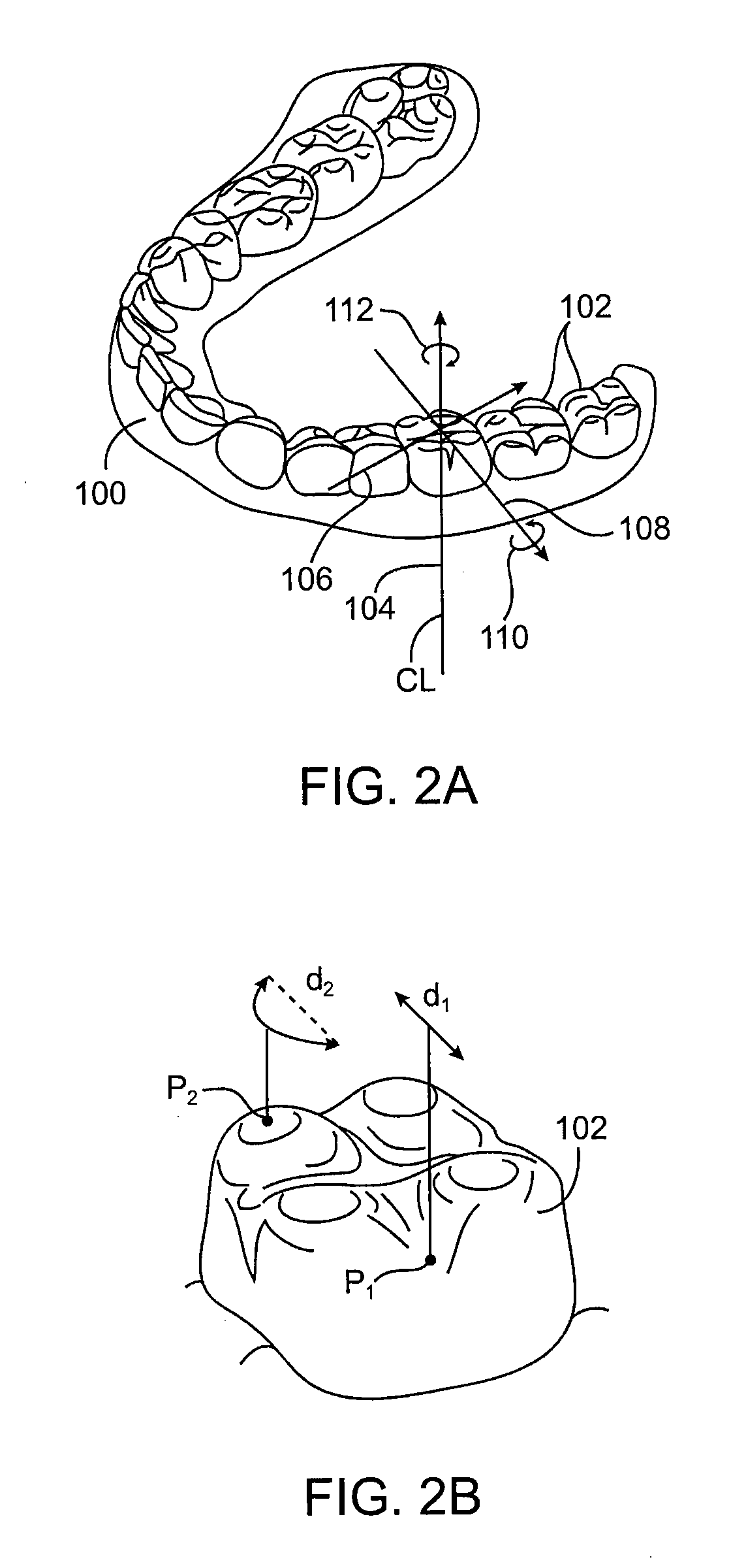 Tooth movement measurement by automatic impression matching