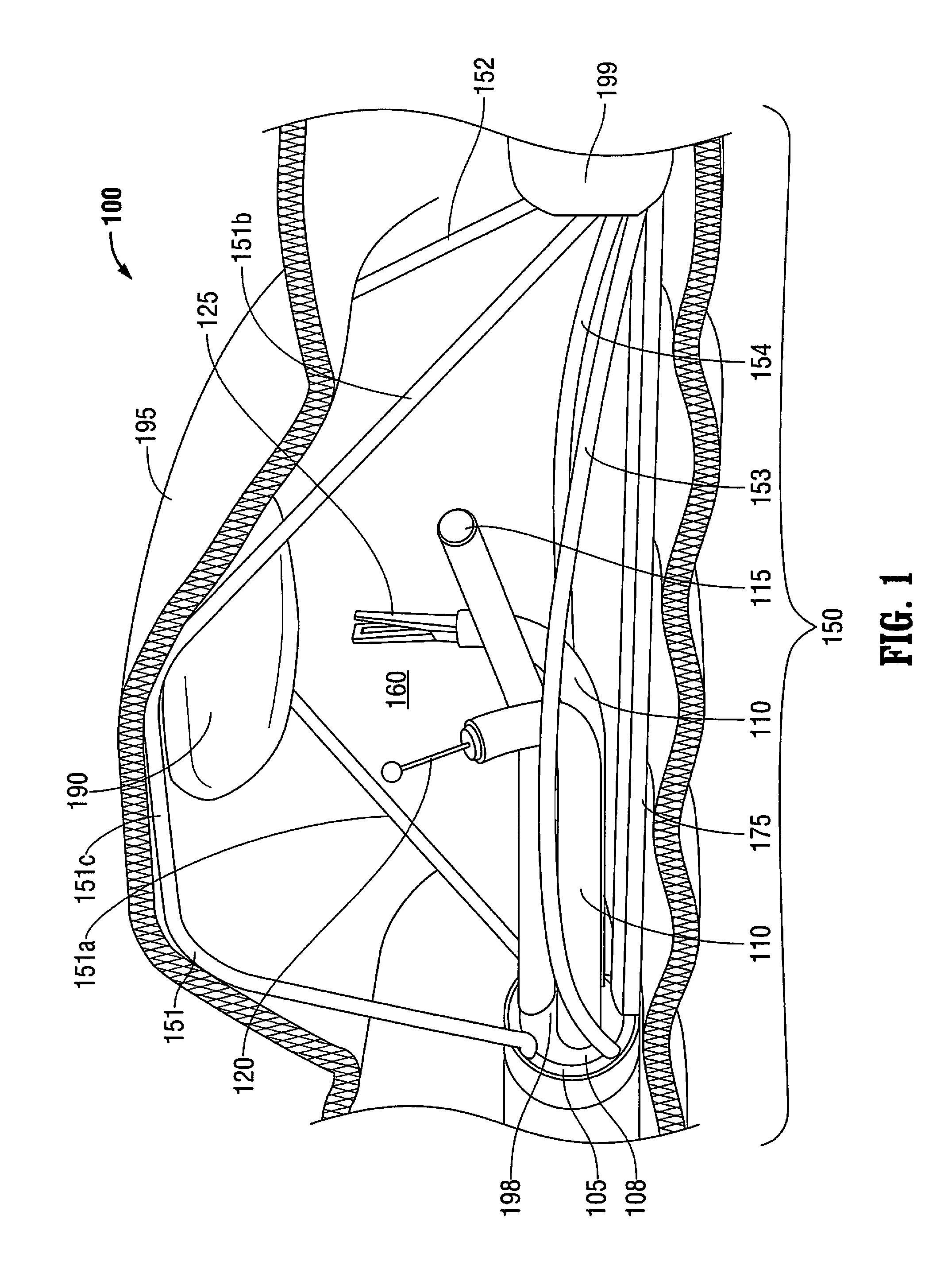 System for a minimally-invasive, operative gastrointestinal treatment