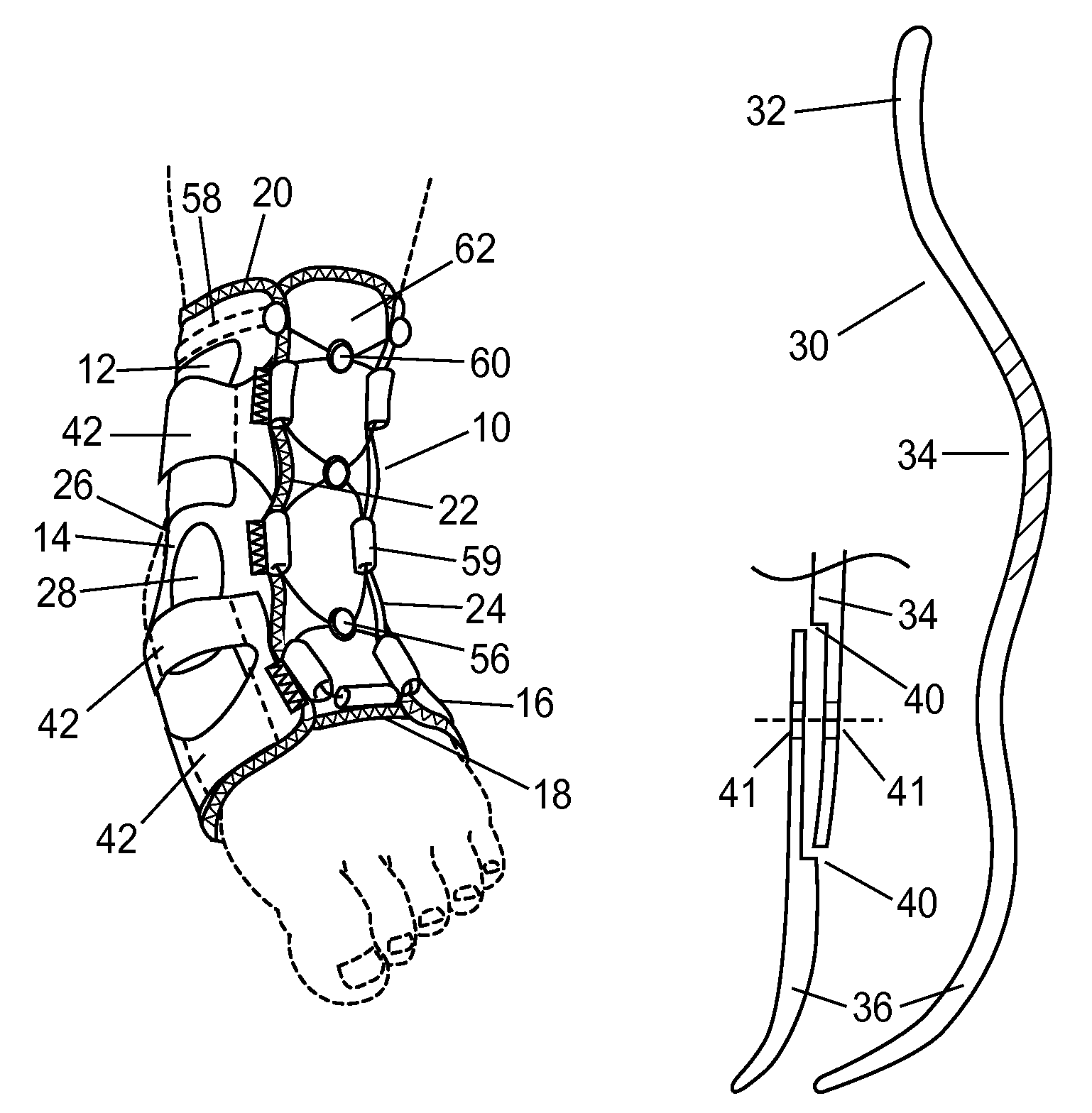 Ankle support with splint and method of using same