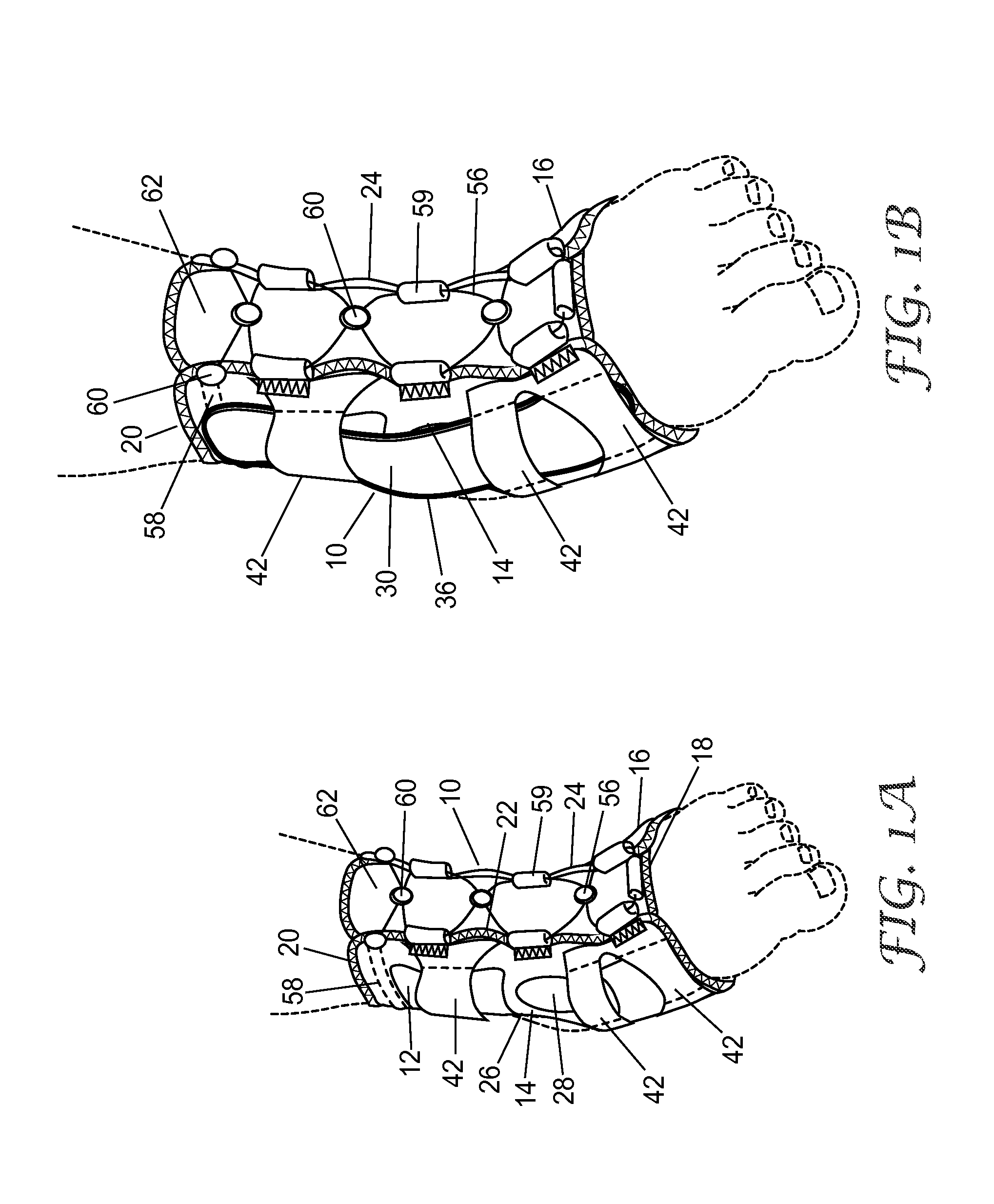 Ankle support with splint and method of using same