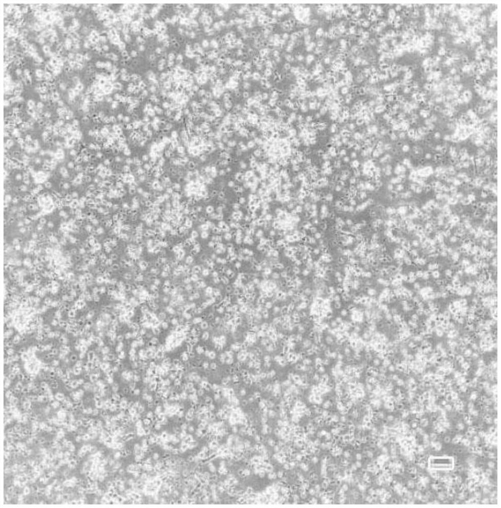 In-vitro activation method of cytokine-induced killer cells