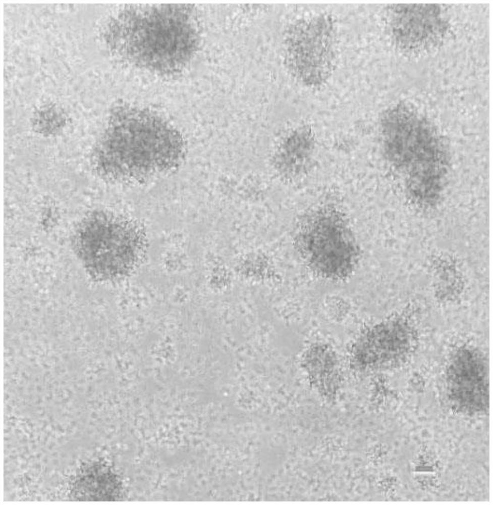 In-vitro activation method of cytokine-induced killer cells