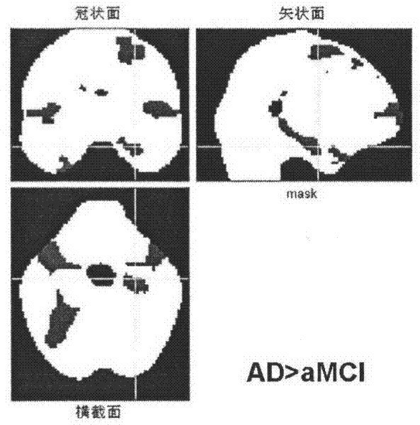 Method for establishing water molecule diffusion model in human brain