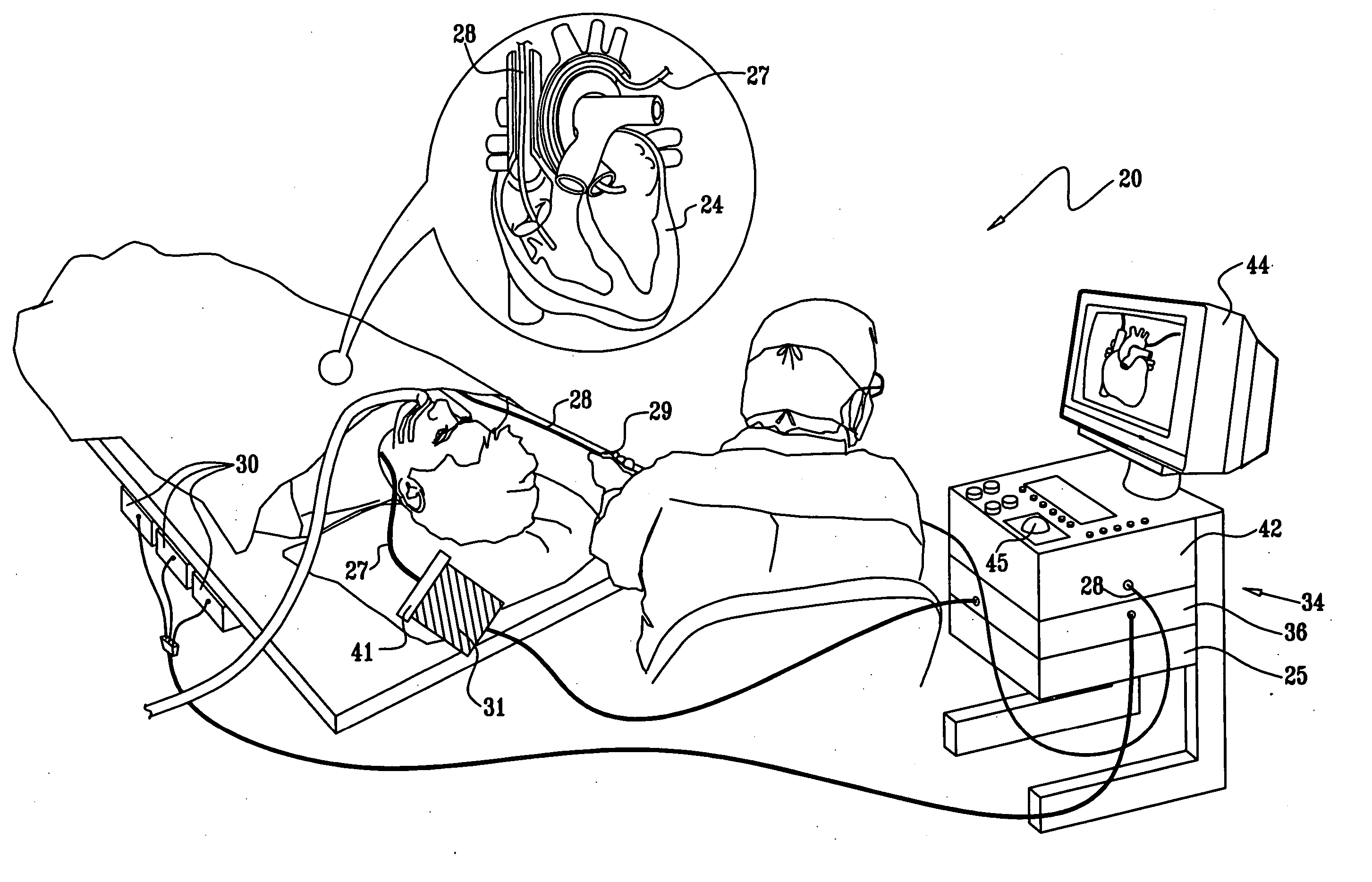 Controlling direction of ultrasound imaging catheter