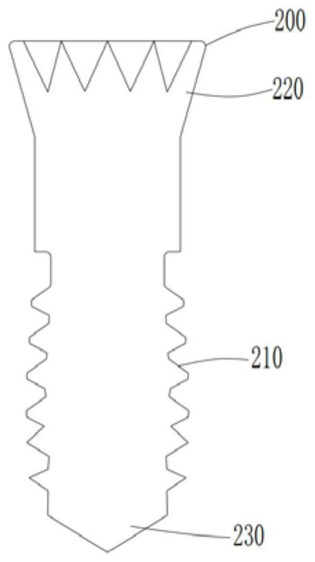 Dental implant structure and preparation method thereof