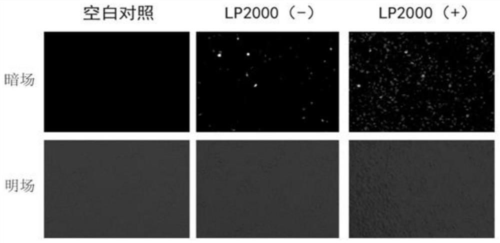 Use of lycium barbarum polysaccharides in preparation of medicines for dilatating thoracic aorta