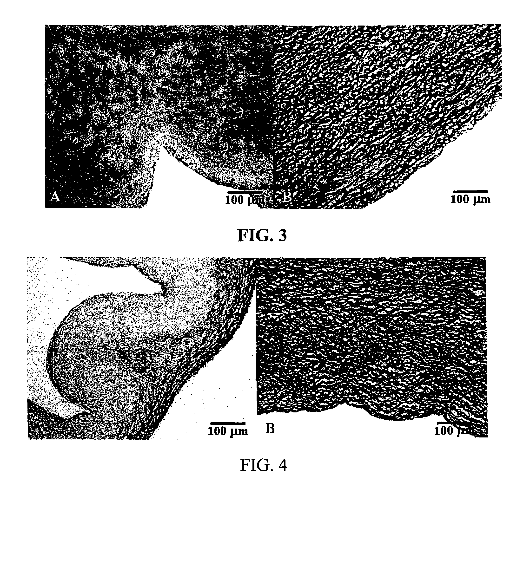 Process for reducing mineralization of tissue used in transplantation