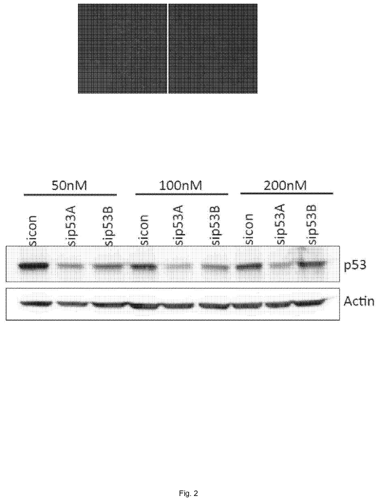 Methods for preventing graft ischemia reperfusion injury during ex vivo machine perfusion preservation