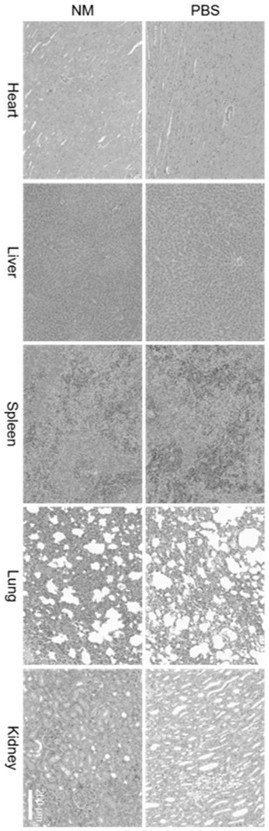 Ultrasonic and near-infrared light excited phase-change magnetic nano thrombolytic drug and preparation method thereof