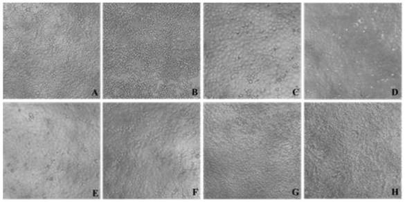 Application of isorhamnetin in treatment of influenza