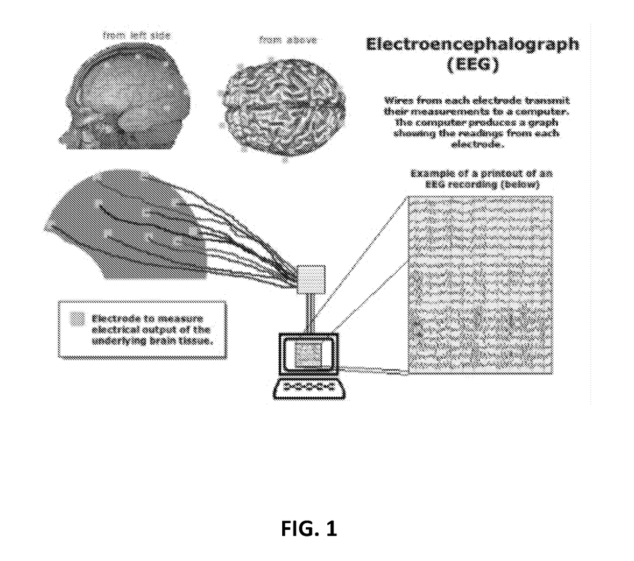 Novel system and method to diagnose and predict different systemic disorders and mental states