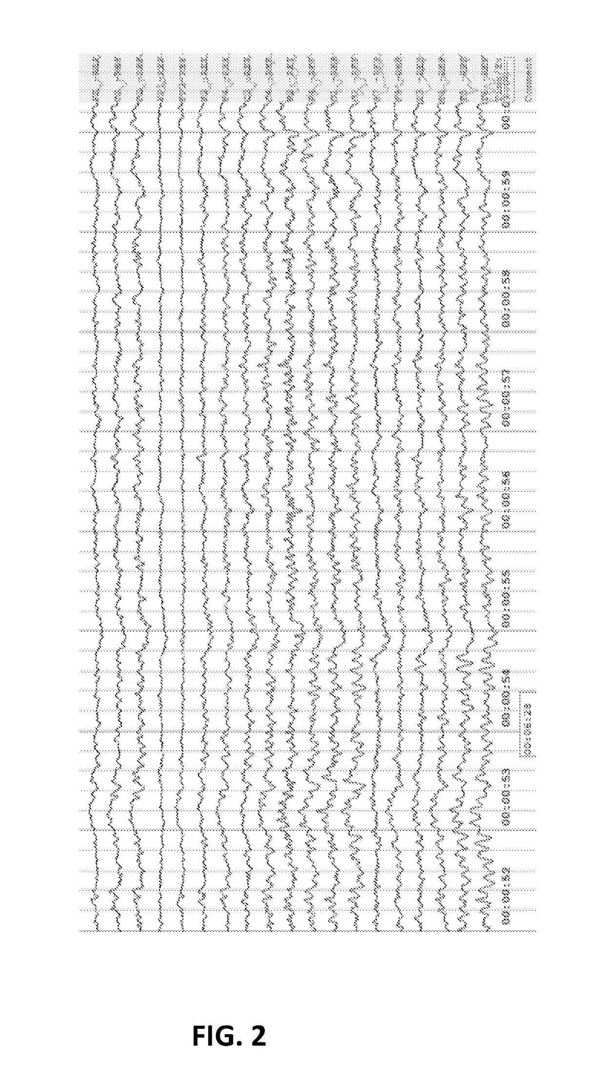 Novel system and method to diagnose and predict different systemic disorders and mental states