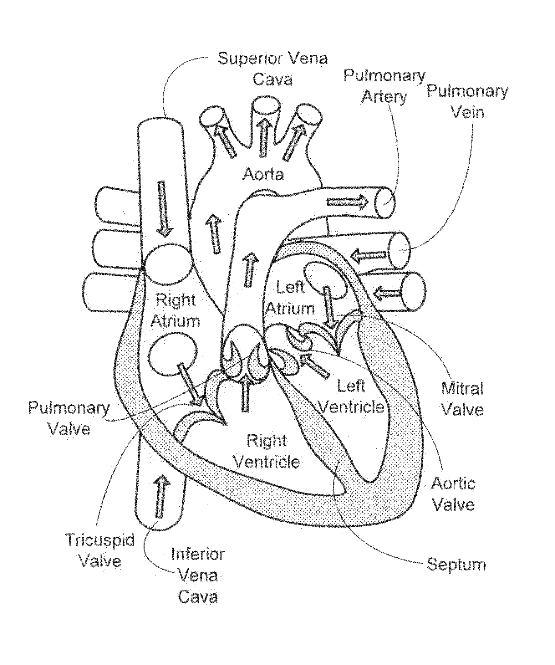 Inflatable exhibit of a human heart and method