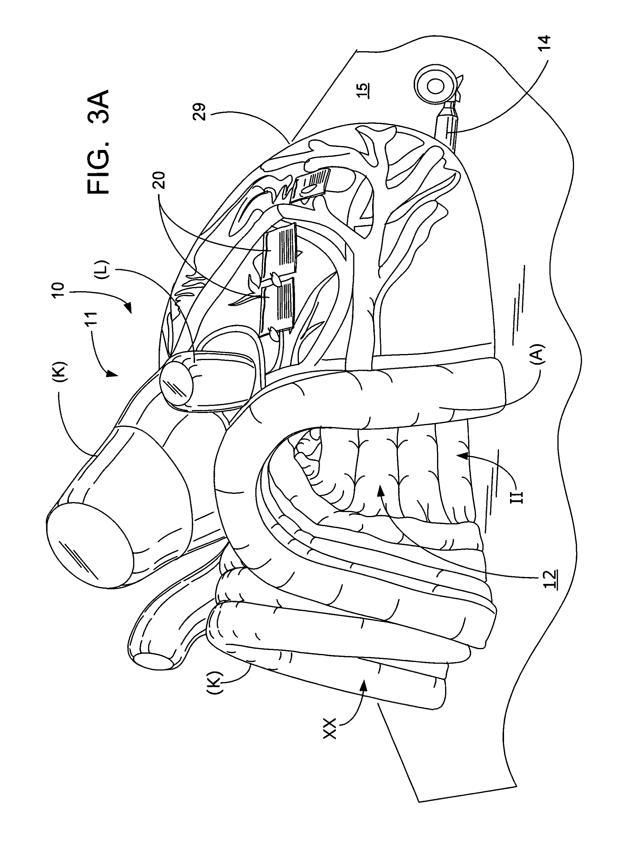 Inflatable exhibit of a human heart and method