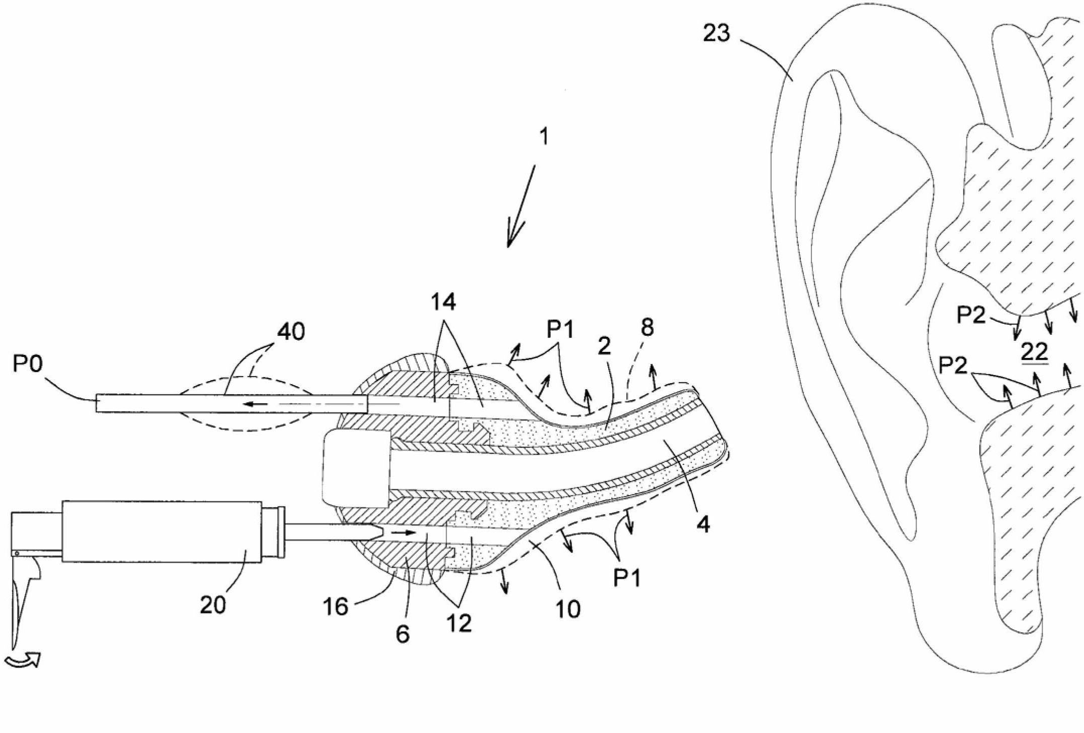 Pressure regulation mechanism for inflatable in-ear device