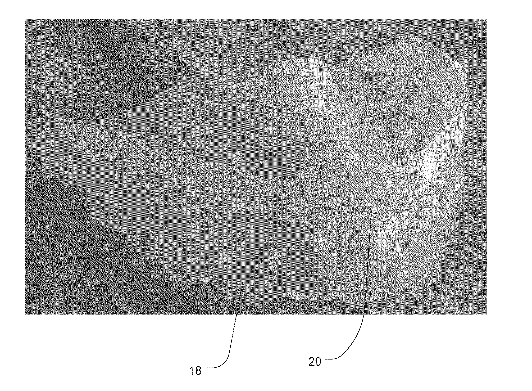 Non-surgical systems and methods for treating receding gums