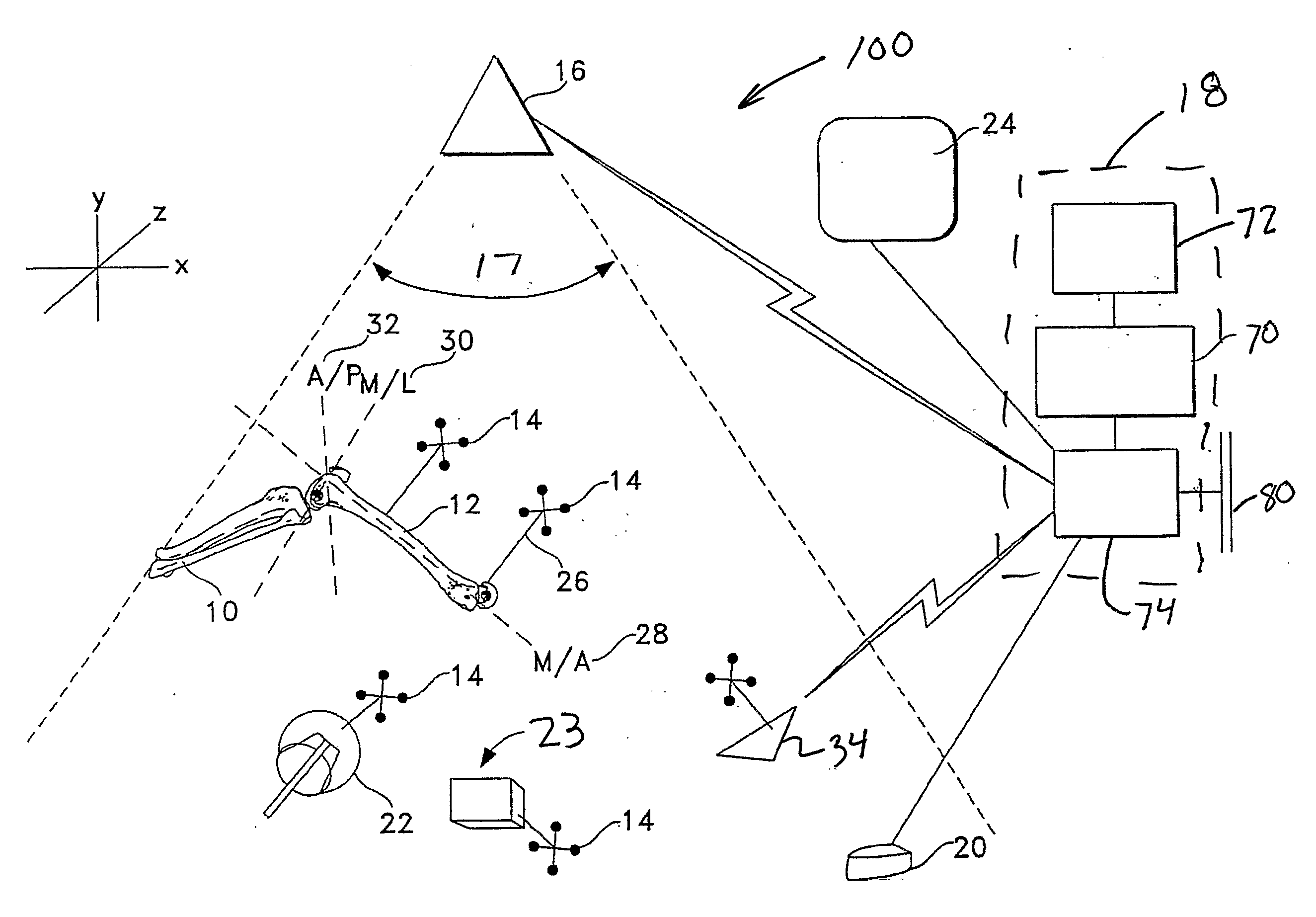 System and Method For Determining Tibial Rotation