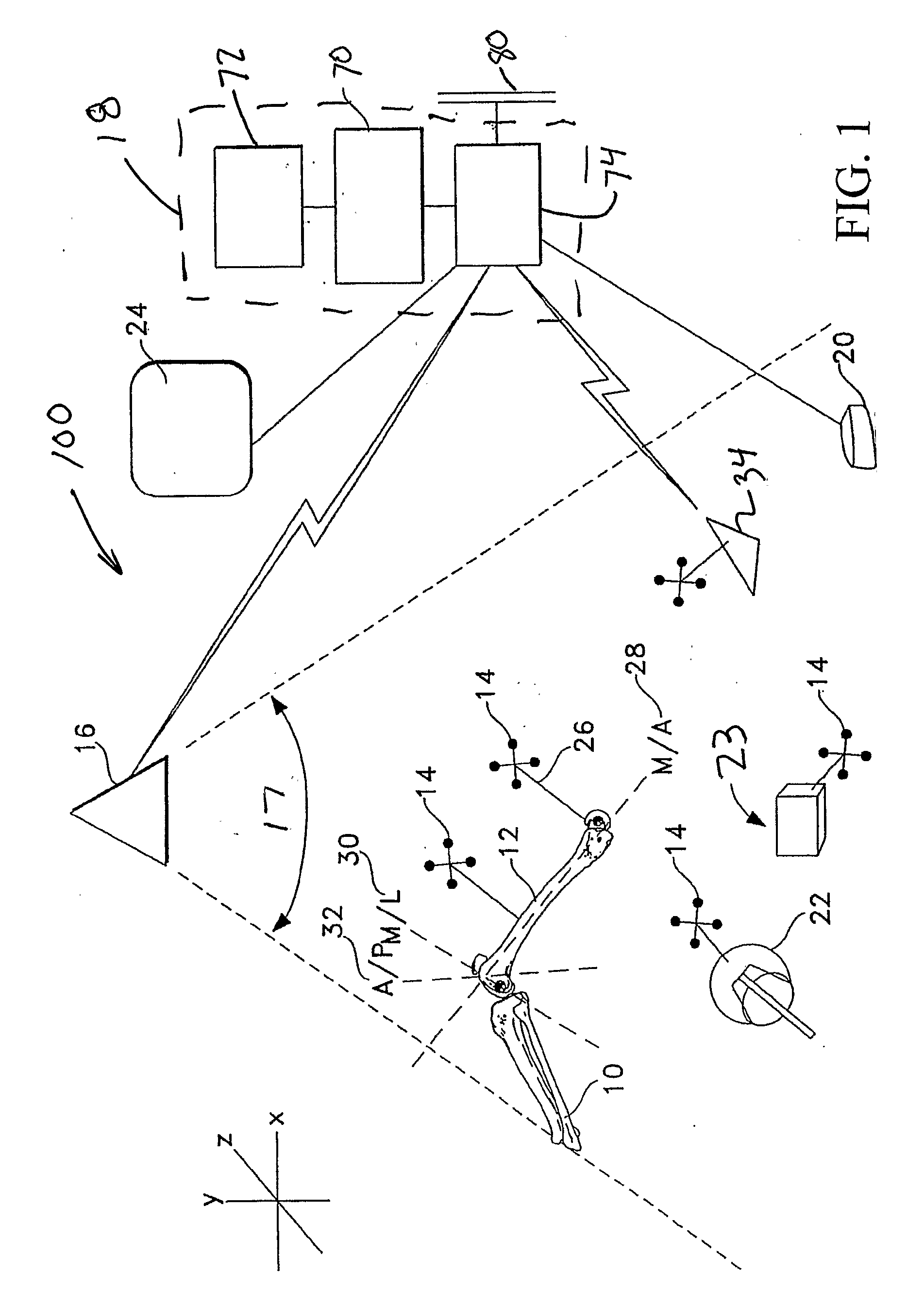 System and Method For Determining Tibial Rotation