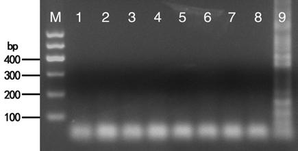 IC-RT-LAMP kit for detecting ToMV virus infecting angelica and detecting method thereof