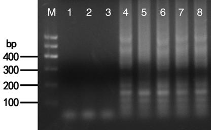 IC-RT-LAMP kit for detecting ToMV virus infecting angelica and detecting method thereof