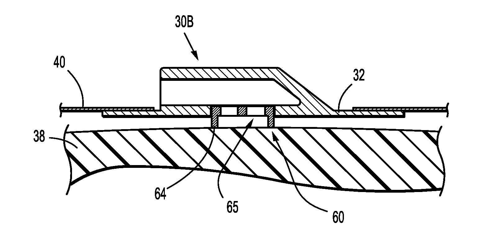 Shear Resistant Wound Dressing for Use in Vacuum Wound Therapy