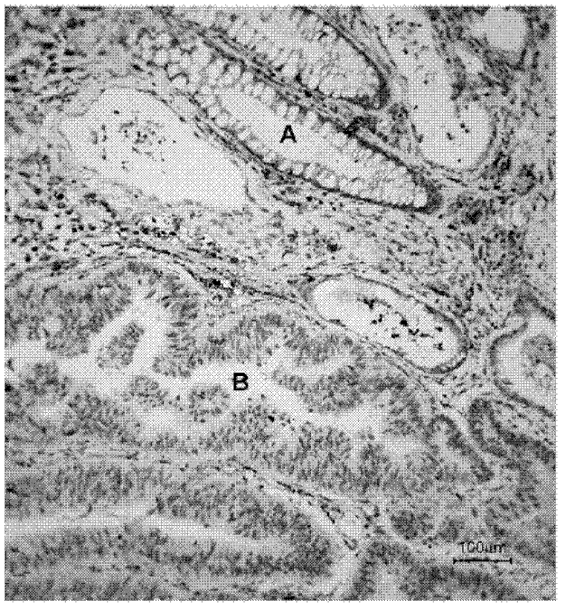 Immunohistochemical staining detection kit for colorectal cancer and application thereof