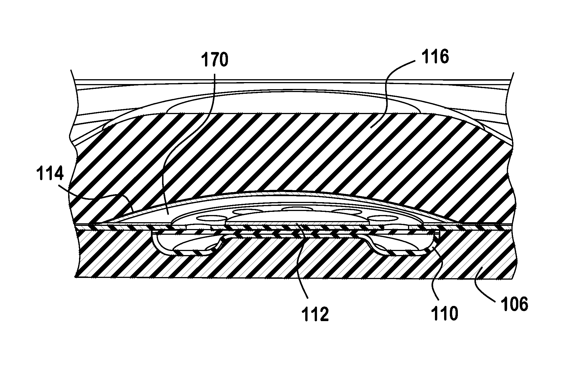 Over-molded keypad and method of manufacture