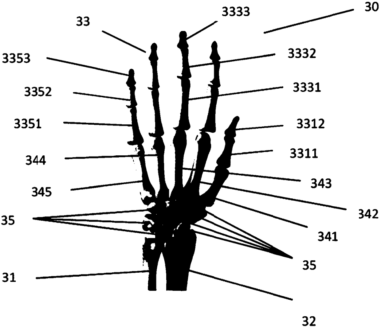 Skeletal age detecting method and device based on depth learning