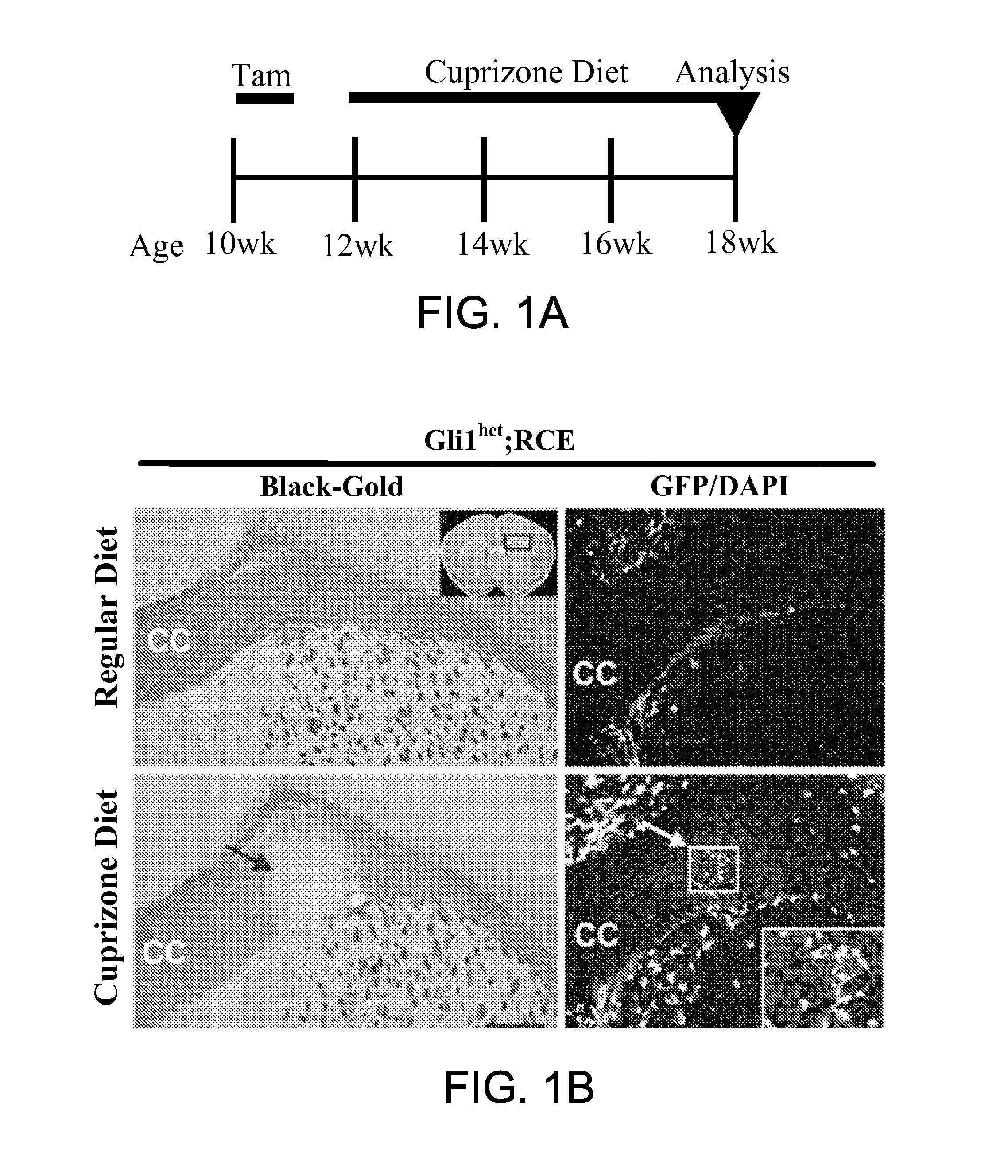 Method for enhancing remyelination using gli1 inhibitors