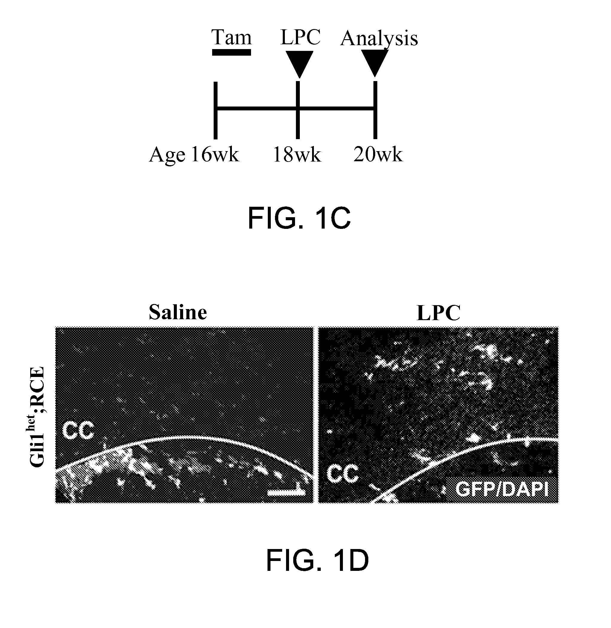 Method for enhancing remyelination using gli1 inhibitors