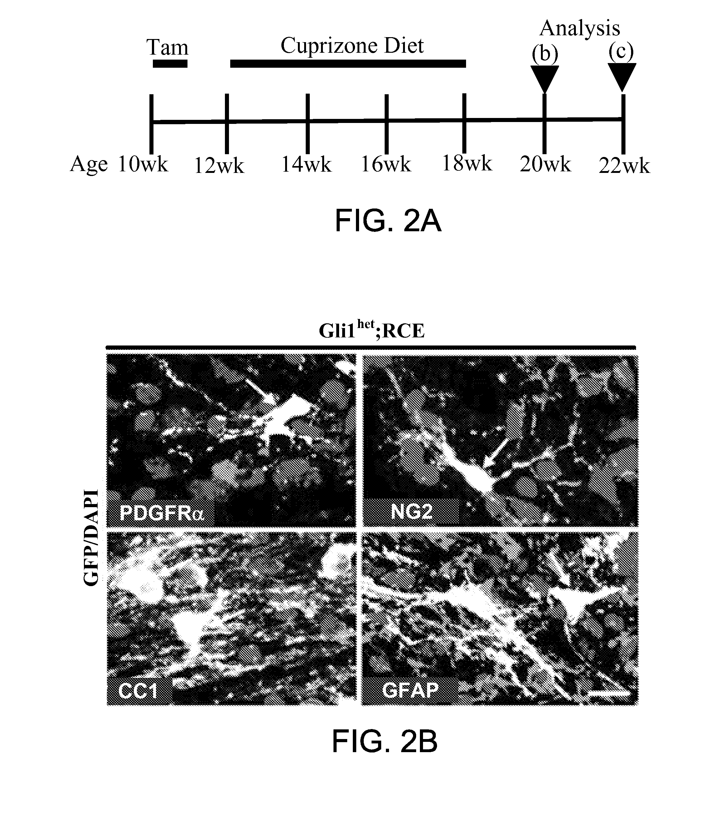 Method for enhancing remyelination using gli1 inhibitors