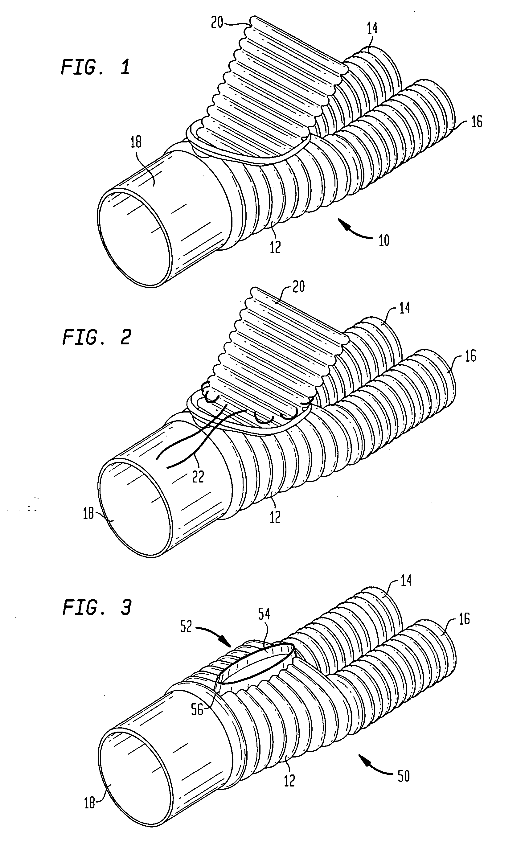 Surgical stapling system