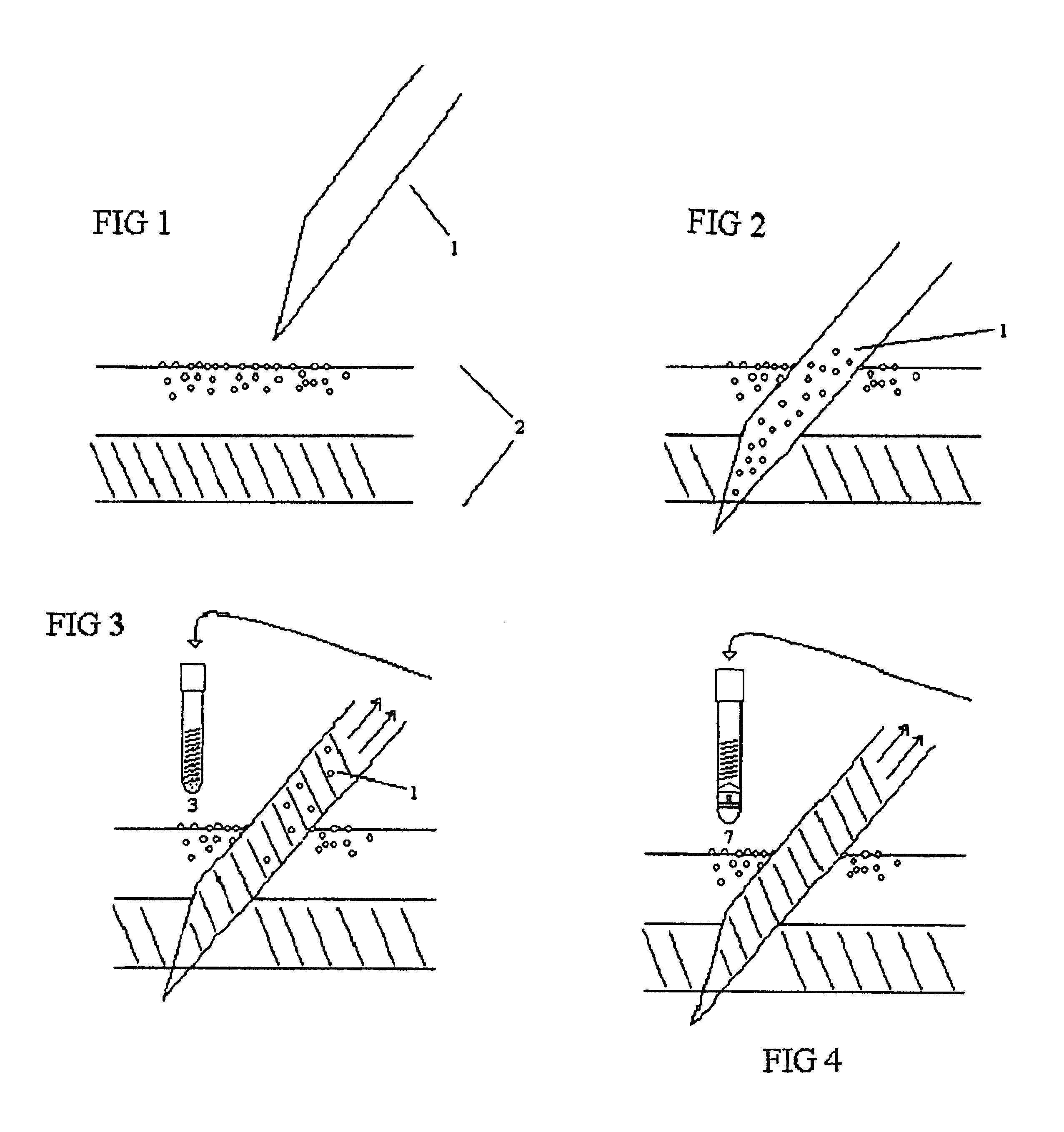 Method of body fluid specimen collection