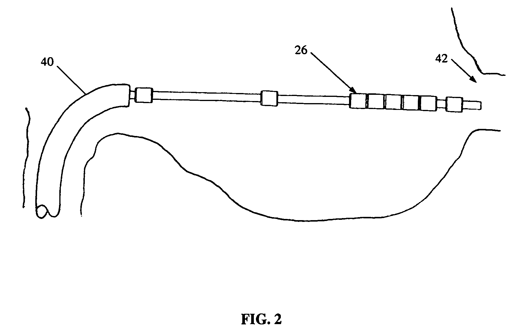 Magnetic navigation manipulation apparatus