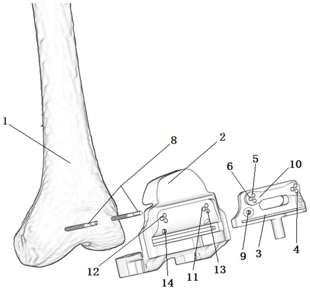 Thighbone osteotomy device and thighbone osteotomy guide plate assembly