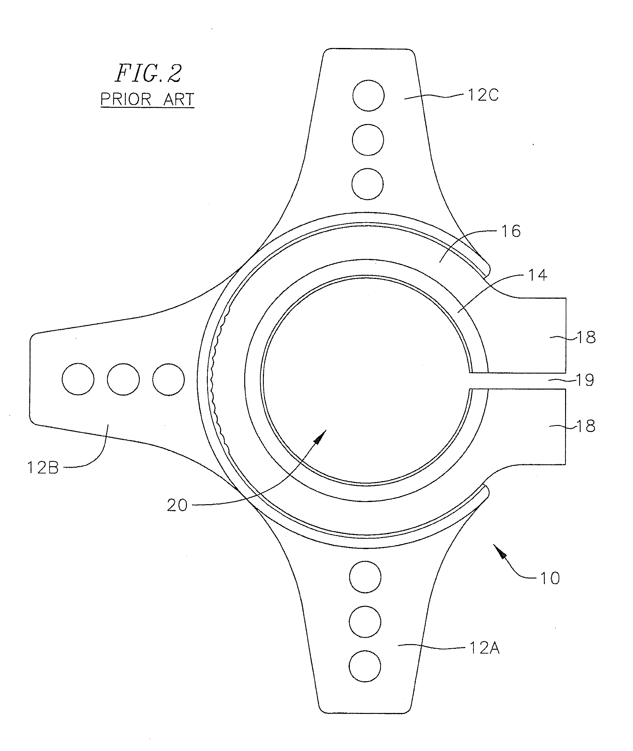 Flexible prong adaptor for stump socket for prosthetics