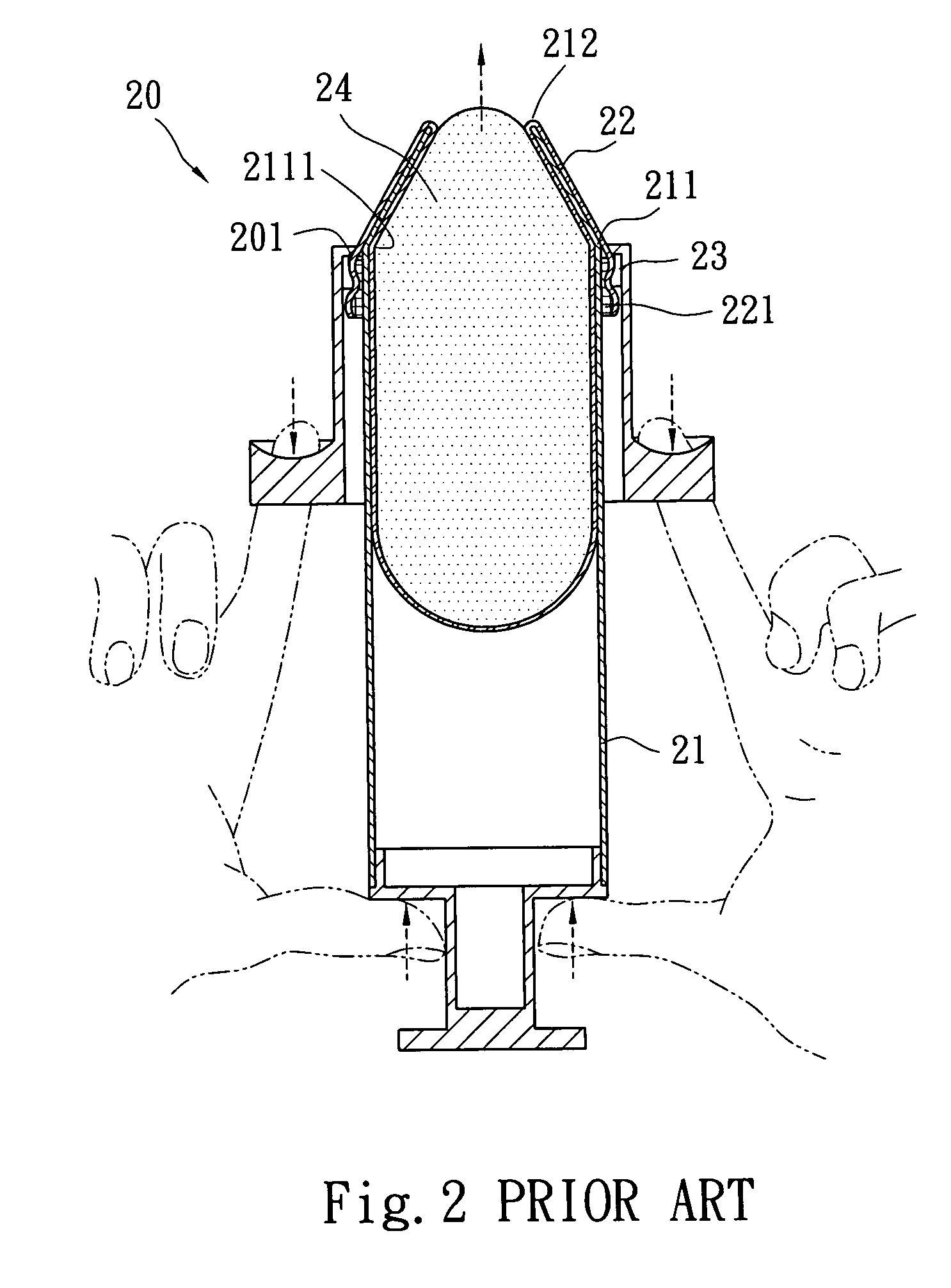 Silicon breast implant injector for augmentation mammaplasty