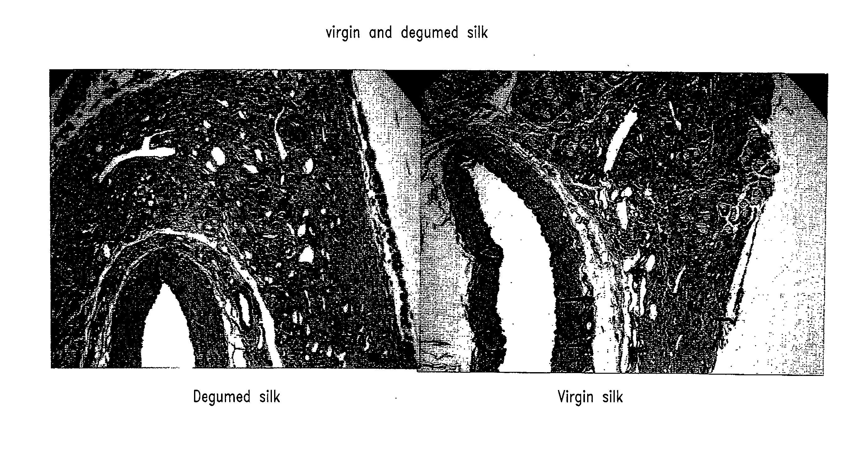 Sutures and fibrosing agents