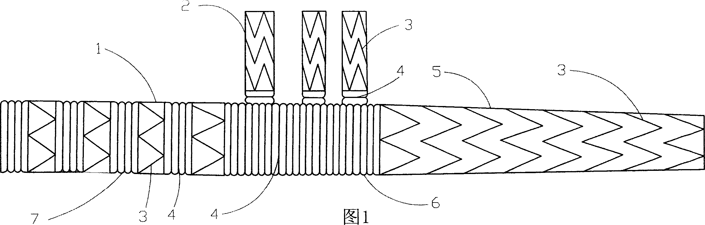 Three-collateral bracket vascellum for arcus aortae