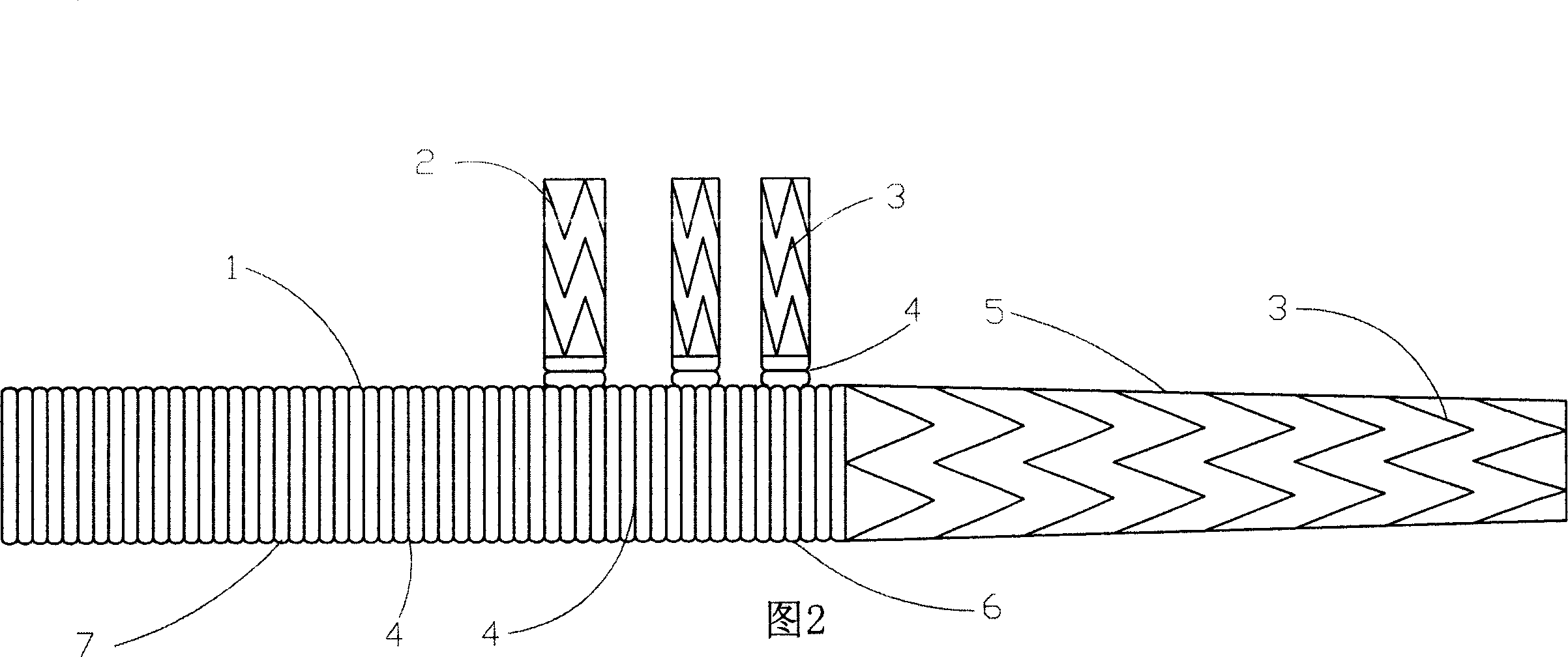 Three-collateral bracket vascellum for arcus aortae