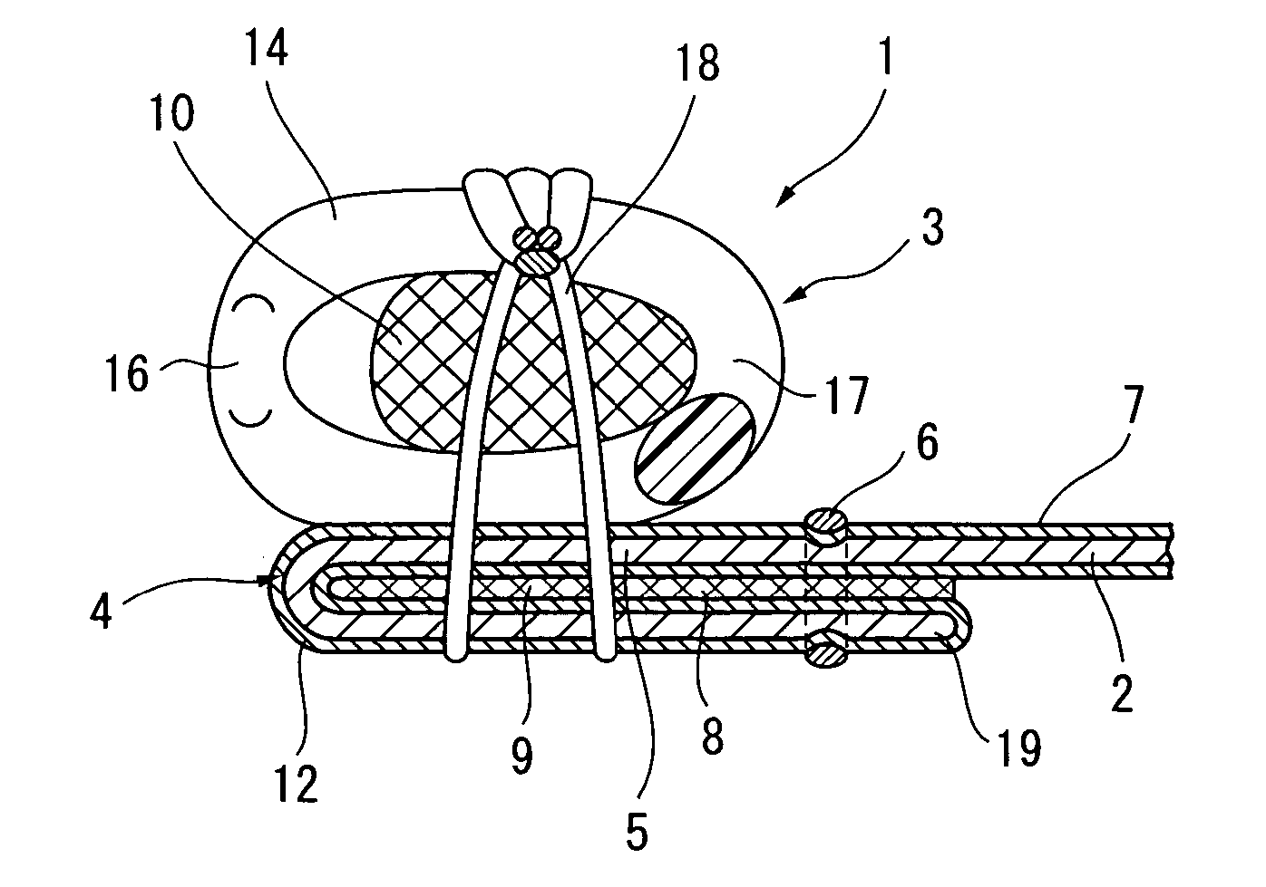 Slide fastener